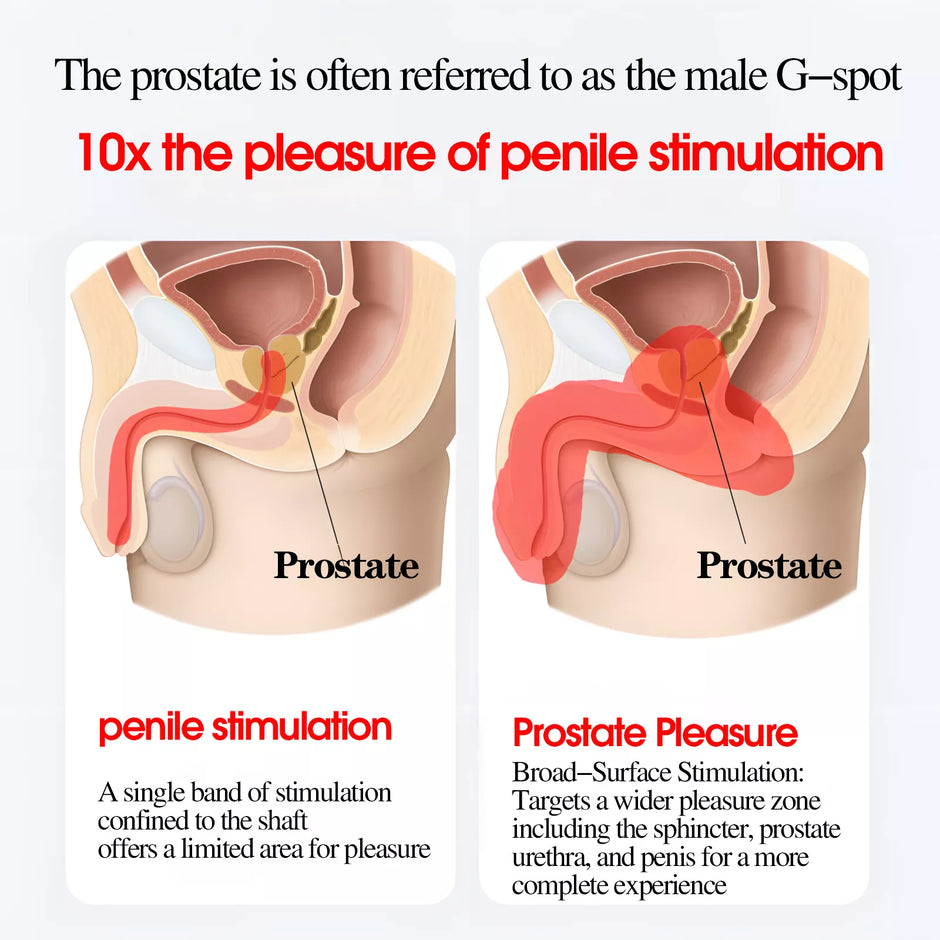 XUNAN Prostate Massager with Cock Ring & Anal Plug Toy